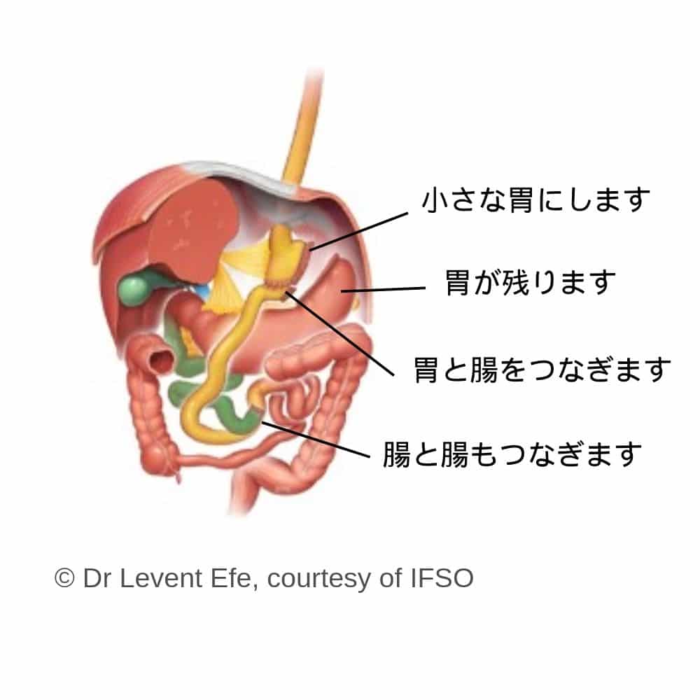 新橋DAYクリニック ダイエット・肥満外来