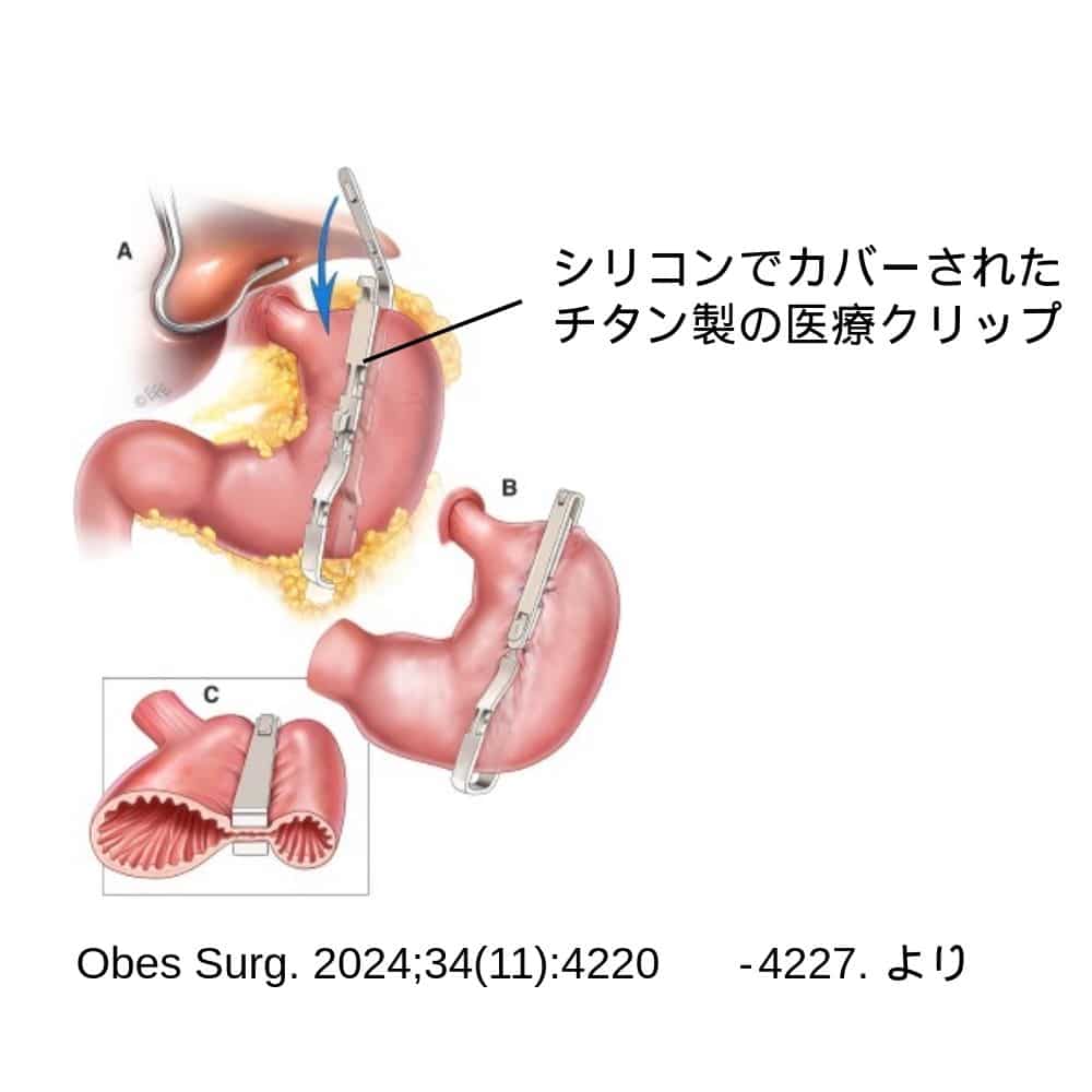 新橋DAYクリニック ダイエット・肥満外来